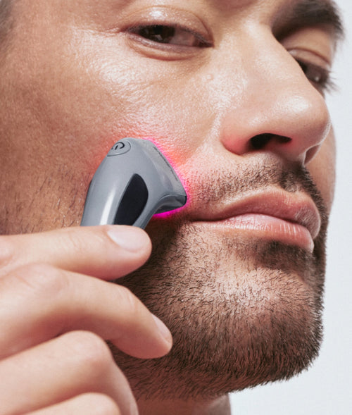 roodlichttherapie voor acne